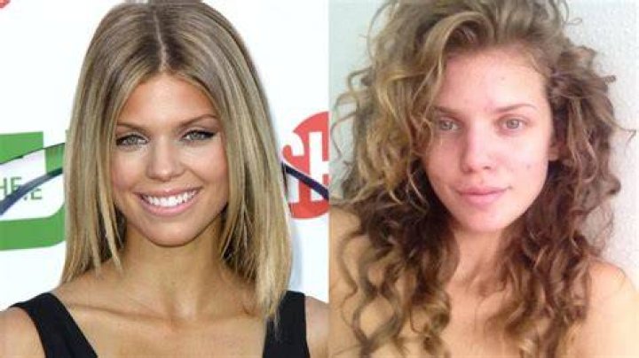 AnnaLynne McCord Plastic Surgery Before and After